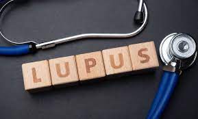 INCMNSZ, referente internacional en investigación sobre lupus