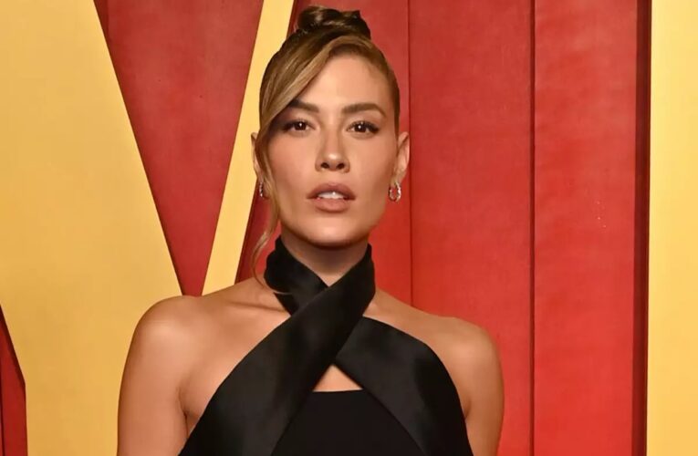 Michelle Salas revela enfermedad que desde hace algunos años padece en la piel