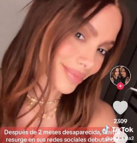 Anitta estrena ‘nuevo rostro’; a través de sus redes sociales se le pudo ver con un drástico cambio físico