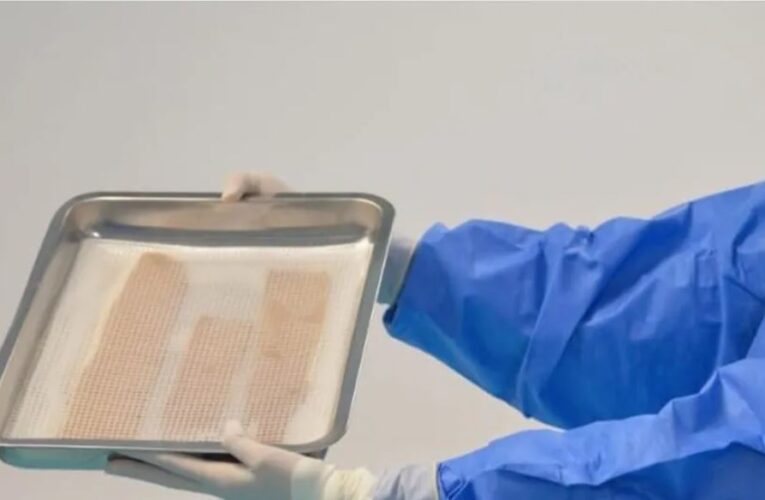 Banco de Tejidos del Edomex dona tejido amniótico para pacientes quemados en Iztapalapa