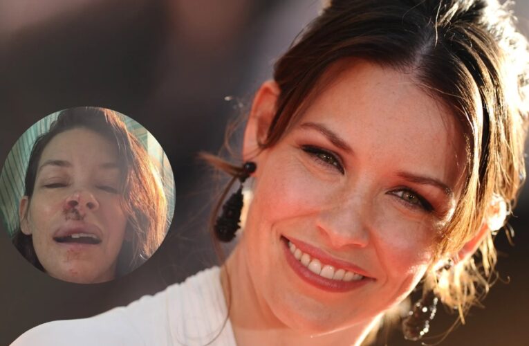 Evangeline Lilly revela daño cerebral tras sufrir un traumatismo craneoencefálico